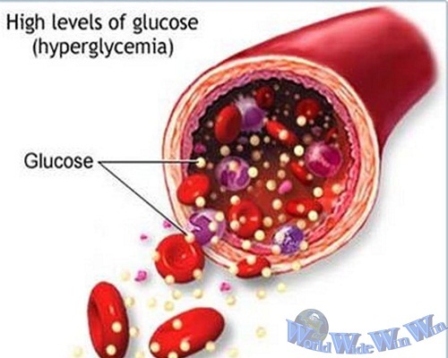 Nguyên nhân, dấu hiệu và triệu chứng của bệnh tiểu đường